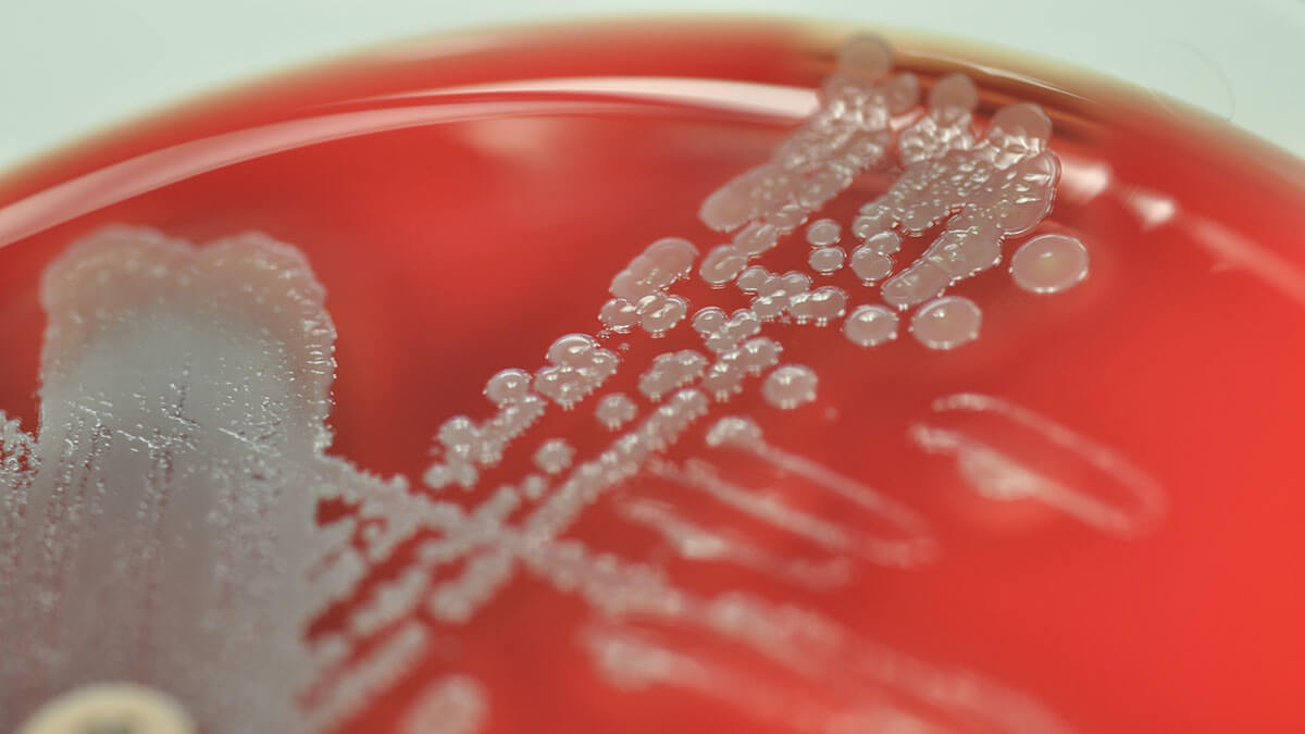 Teaserbild zum CME: Bakterien als Erreger nosokomialer Infektionen